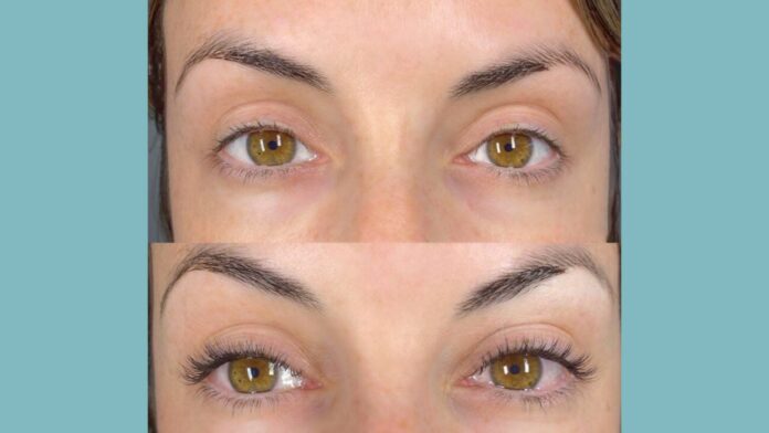 How Long Does a Lash Lift Last