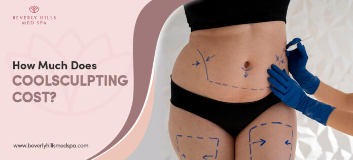 How Much is Coolsculpting