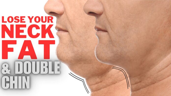 How to Lose Neck Fat